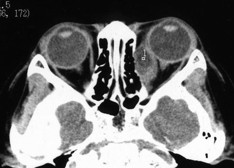 2.jpg (48118 字节)