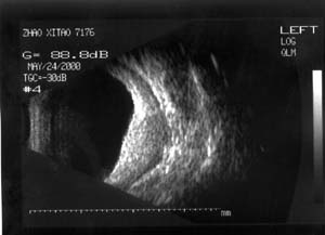 Image2.jpg (11668 字节)