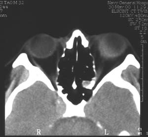 Image3.jpg (15504 字节)