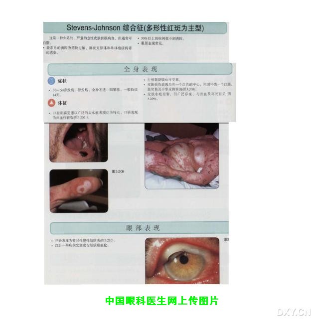 Click to view full 未标题-11.jpg (1134 X 1134)